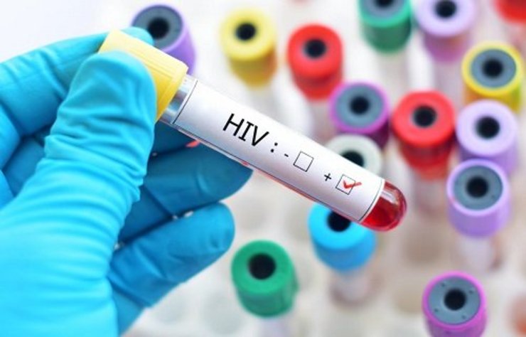 ابتلای ۲۶ نفر به ایدز در یکی از روستاهای «لردگان»