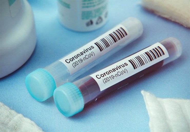 استفاده از کیت‌های دو‌کاره تشخیص هم‌زمان آنفلوانزا و کرونا در آزمایشگاه‌ها