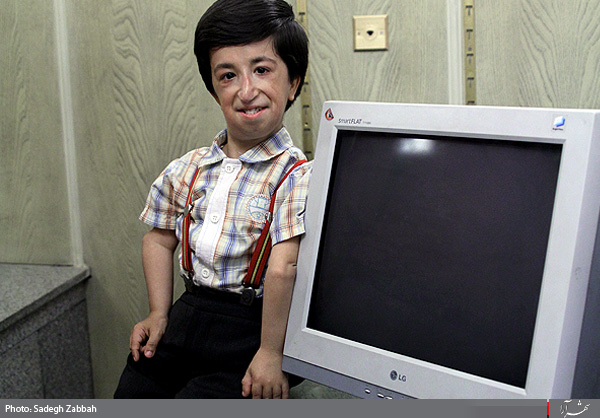 گفتگوي شهرآرا با كوچكترين مرد دنيا