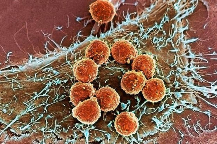 شکار سلول‌های سرطان کشنده مغز با ویروس اِبولا