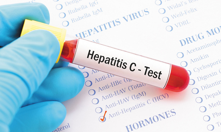 ۱۰ درصد مبتلایان به هپاتیت سی در خراسان رضوی درمان شده‌اند