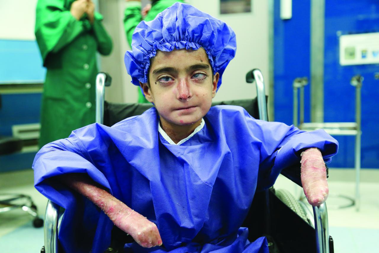 روایتی از زندگی بیماران «ایبی» که روزگار سختی را سپری میکنند روایتی از زندگی بیماران «ایبی» که روزگار سختی را سپری میکنند