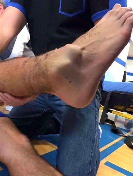فیلم لحظه شکستن پای آندره گومز بازیکن اورتون