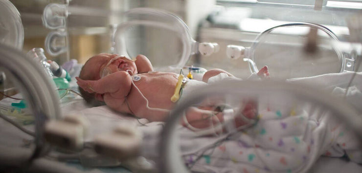 تست کرونای نوزاد ۸۰۰ گرمی در یزد مثبت اعلام شد