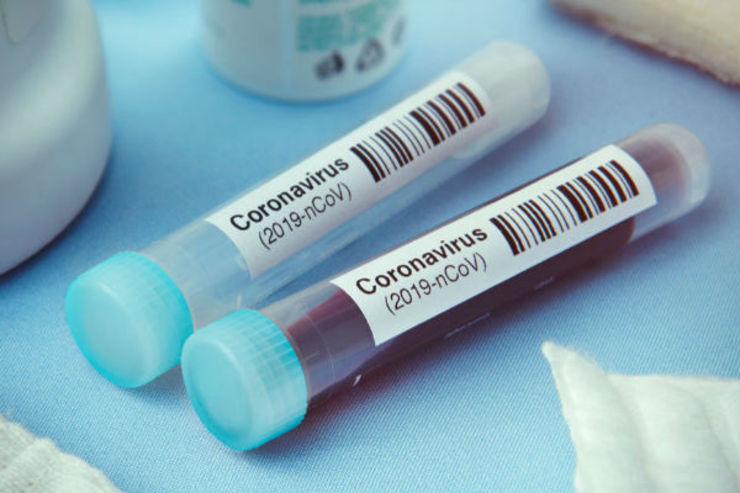 مجوز تست اولین پادتن برای تشخیص کرونا در آمریکا صادر شد