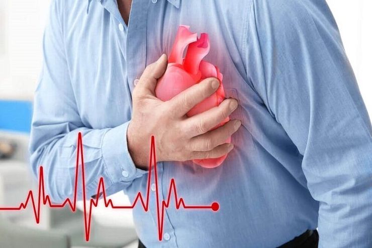 حمله قلبی و آنچه باید بدانیم