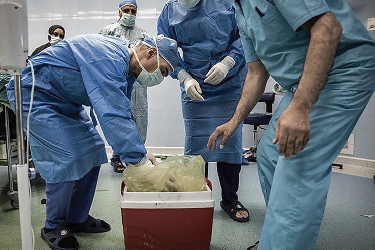 اهدای عضو در بیمارستان منتصریه مشهد، جان ۴ بیمار را نجات داد
