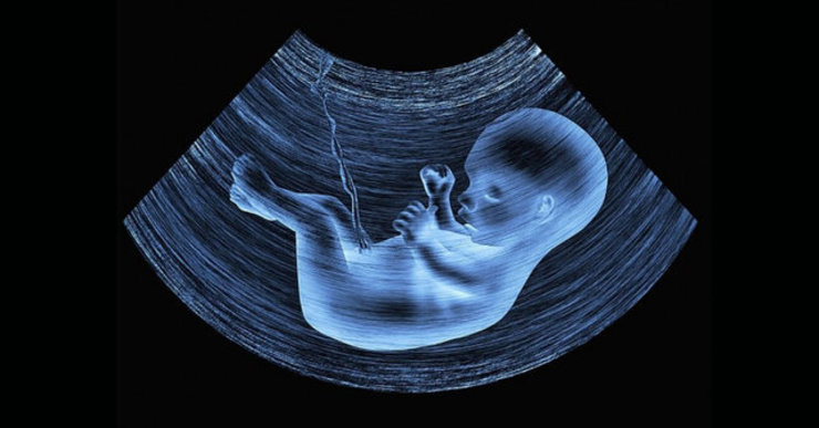 مخالفت مجلس با اجباری شدن غربالگری در دوران بارداری