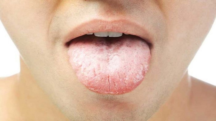 علل بوی بد دهان چیست و چگونه از بین می‌رود؟