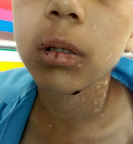 جرئیات تکان‌دهنده از کودک‌آزاری پسر ۹ساله در سبزوار + عکس