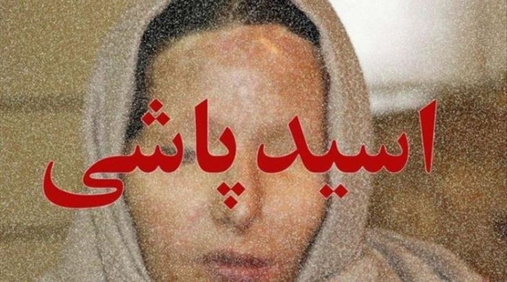 پوشاندن لباس‌های برند بر تن قربانیان اسیدپاشی برای نخستین بار در ایران