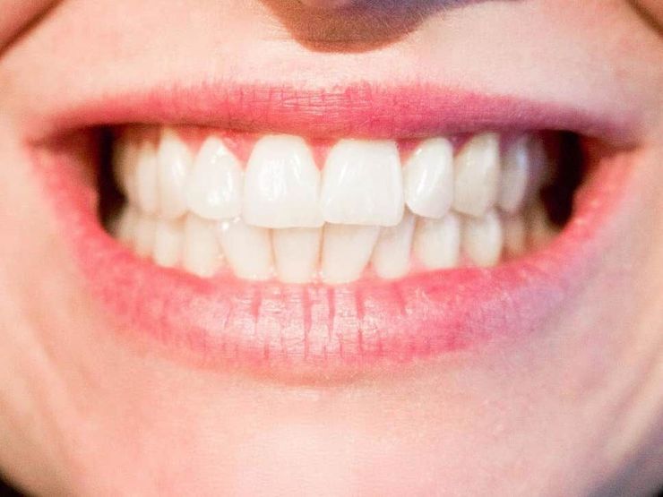راه‌هایی برای داشتن دندان‌های زیبا