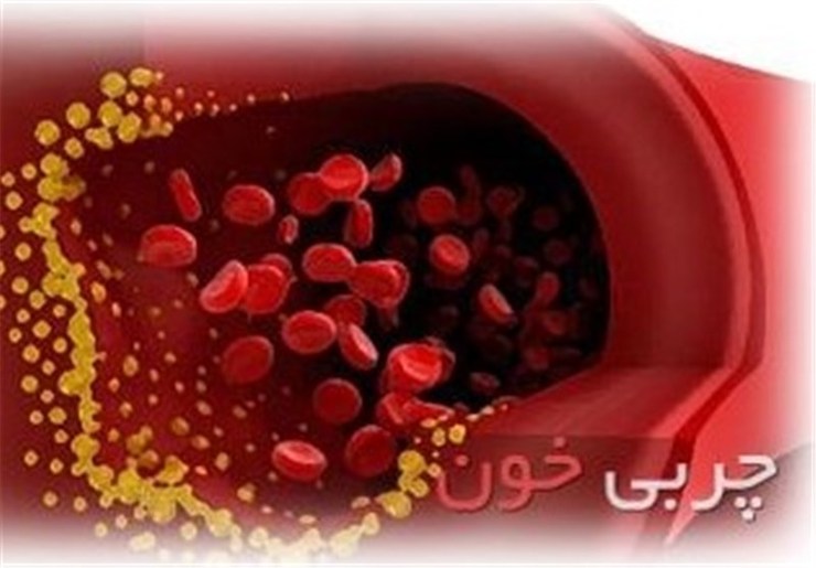 ۷۰ درصد جمعیت خراسان رضوی چربی خون مزمن دارند