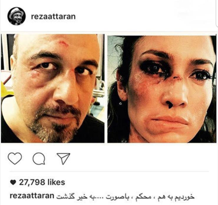 صورت زخمی رضا عطاران پس از تصادف + عکس