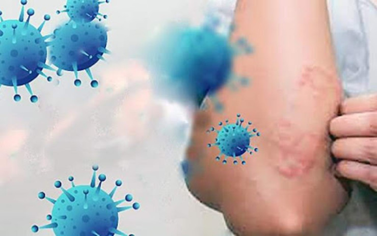 اگر ویروس کرونا روی پوستمان بنشیند چه می‌شود؟