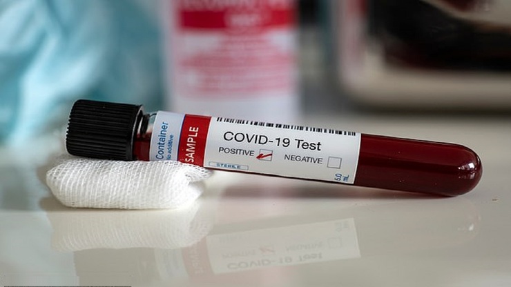 تشخیص مرگبار بودن کرونا با آزمایش خون