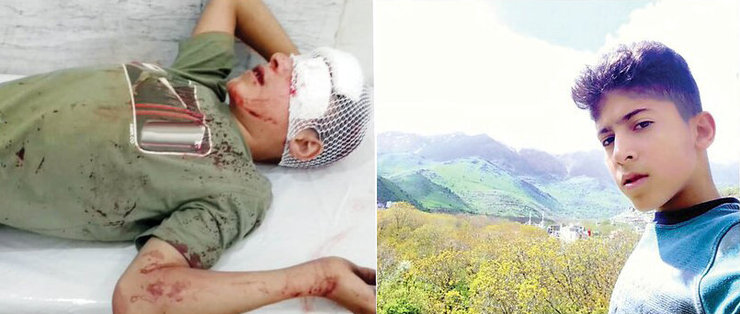 سقوط کولبر ۱۴ ساله از کوه | درمان «مانی» به دلیل مشکلات مالی متوقف شده است