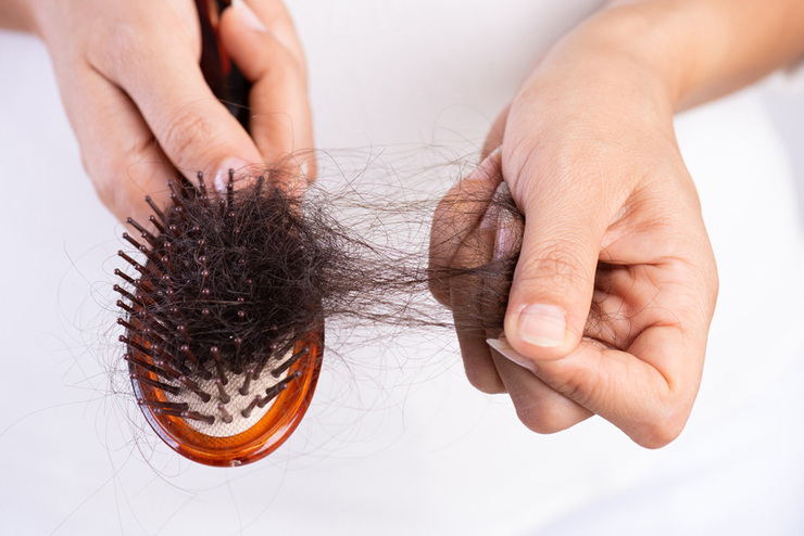 دلایل ریزش مو در خانم‌ها چیست؟