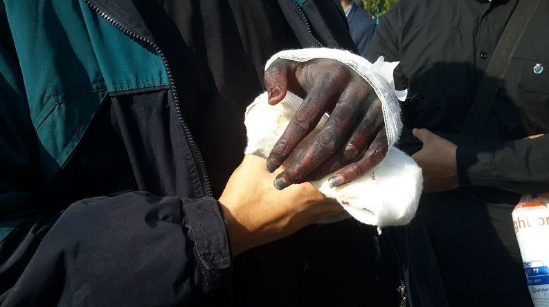 ماجرای قطع دست یک کشتی گیر توسط اراذل و اوباش + عکس