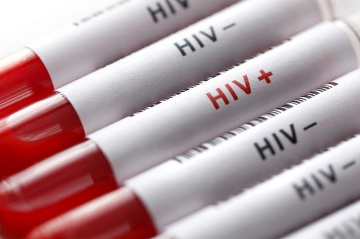 شناسایی۷۰۰ مبتلا به HIV در مشهد