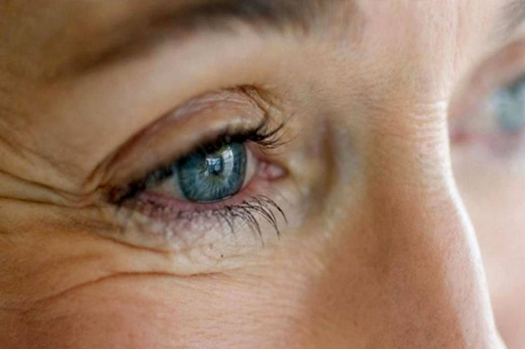 برای جلوگیری از پیری زودرس چشم چه باید کرد؟