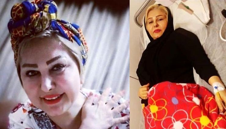 زیبا مهرعلیزاده، بازیگر شیرازی سینما و تلویزیون درگذشت + بیوگرافی و علت فوت