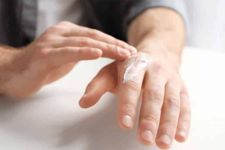 علت خشکی و ترک‌خوردگی دست چیست؟ + روش درمان