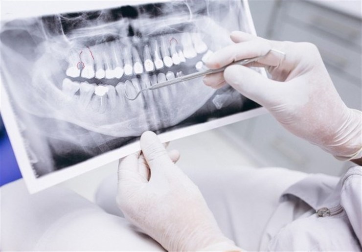 آغاز ارائه تسهیلات دندانپزشکی به بازنشستگان کشوری