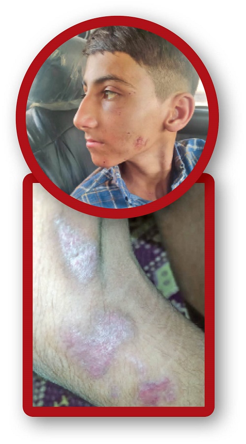 ماجرای هولناک گروگانگیری ۳ نوجوان در داراب فارس | ۵۹ روز اسارت و شکنجه در کوه + تصاویر