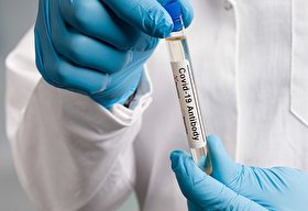 آیا پس از تزریق واکسن کرونا، باید تست آنتی‌بادی بدهیم؟