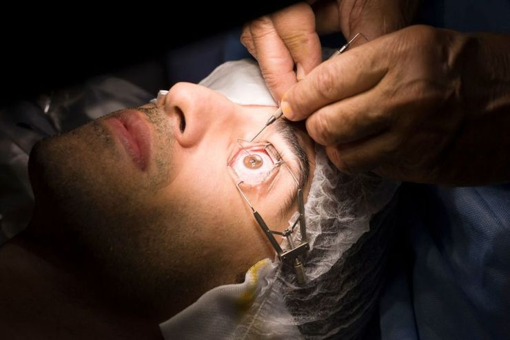آیا عمل لیزر چشم مفید است؟