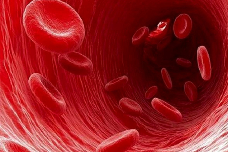 کم خونی در مردان چه علائمی دارد؟