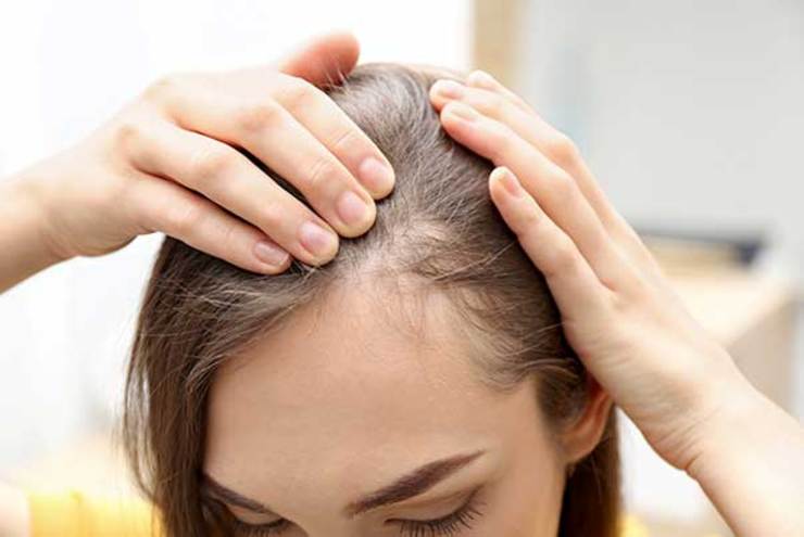 راهکار موثر برای جلوگیری از ریزش مو