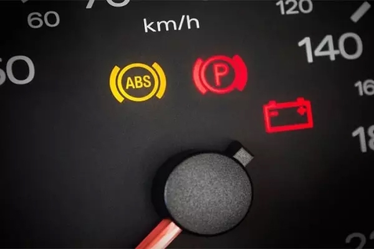 علت روشن شدن چراغ ABS چیست؟ + دلایل و راه حل