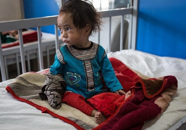 نگرانی‌ها از افزایش آمار کودکان به سوء تغذیه در افغانستان