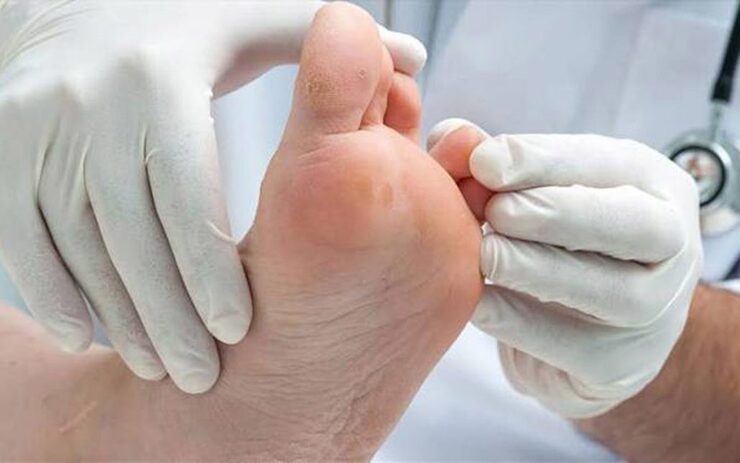 استادیار گروه ژنتیک پزشکی و پزشکی مولکولی دانشگاه علوم پزشکی مشهد از راه اندازی درمانگاه زخم پای دیابتی و سلول‌های بنیادی و پزشکی بازساختی در کلینیک مستقل زکریا این دانشگاه خبر داد.