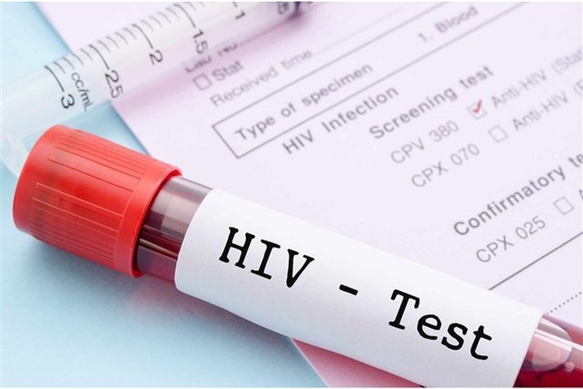از وضعیت HIV در ایران چه می‌دانیم؟