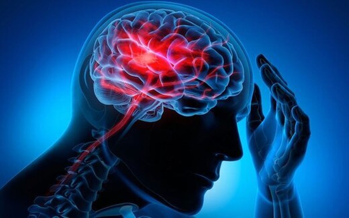 چطور از سکته مغزی جلوگیری کنیم؟