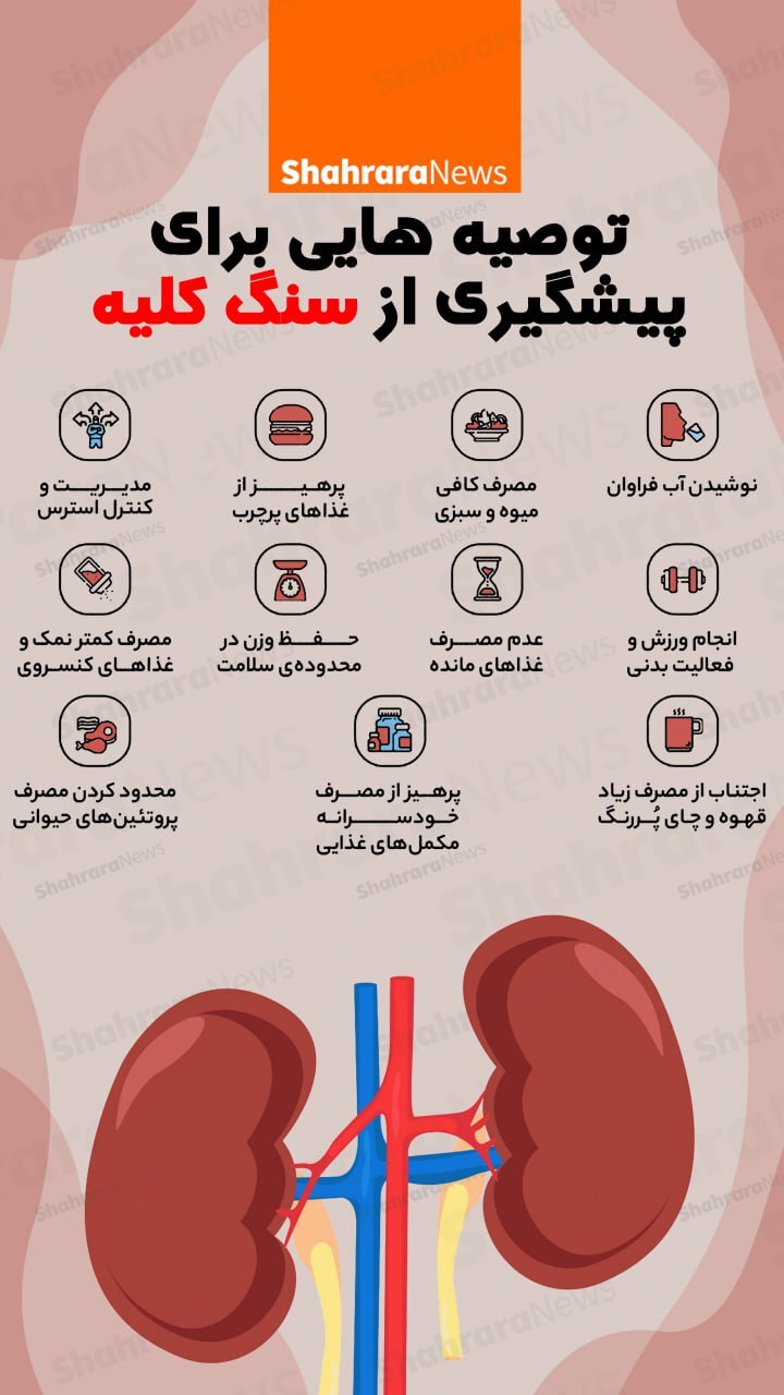 اینفوگرافی| توصیه‌هایی برای پیشگیری از سنگ کلیه