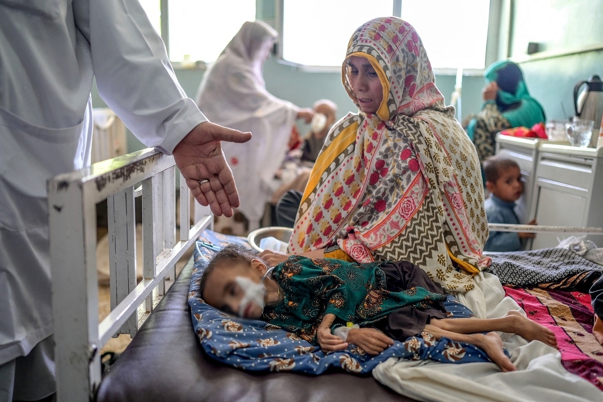 افزایش سوءتغذیه میان کودکان در افغانستان