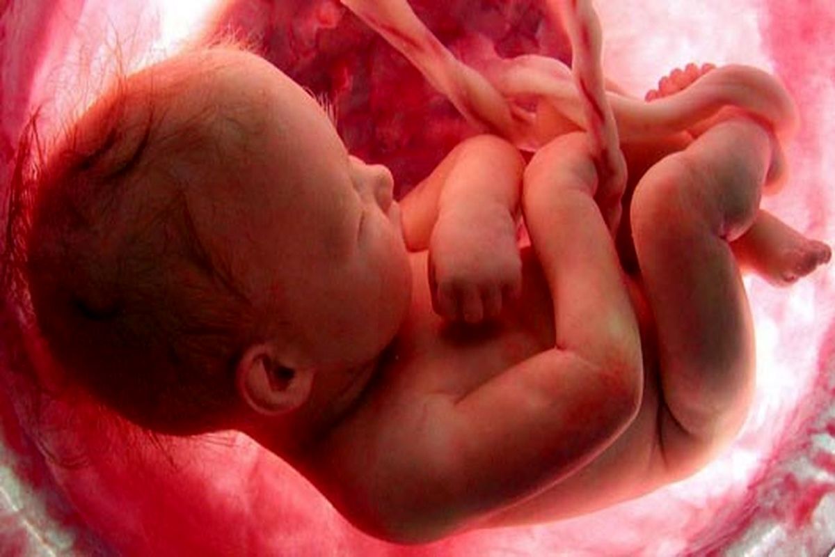 واکنش وزارت بهداشت به خبر ممنوعیت غربالگری جنین