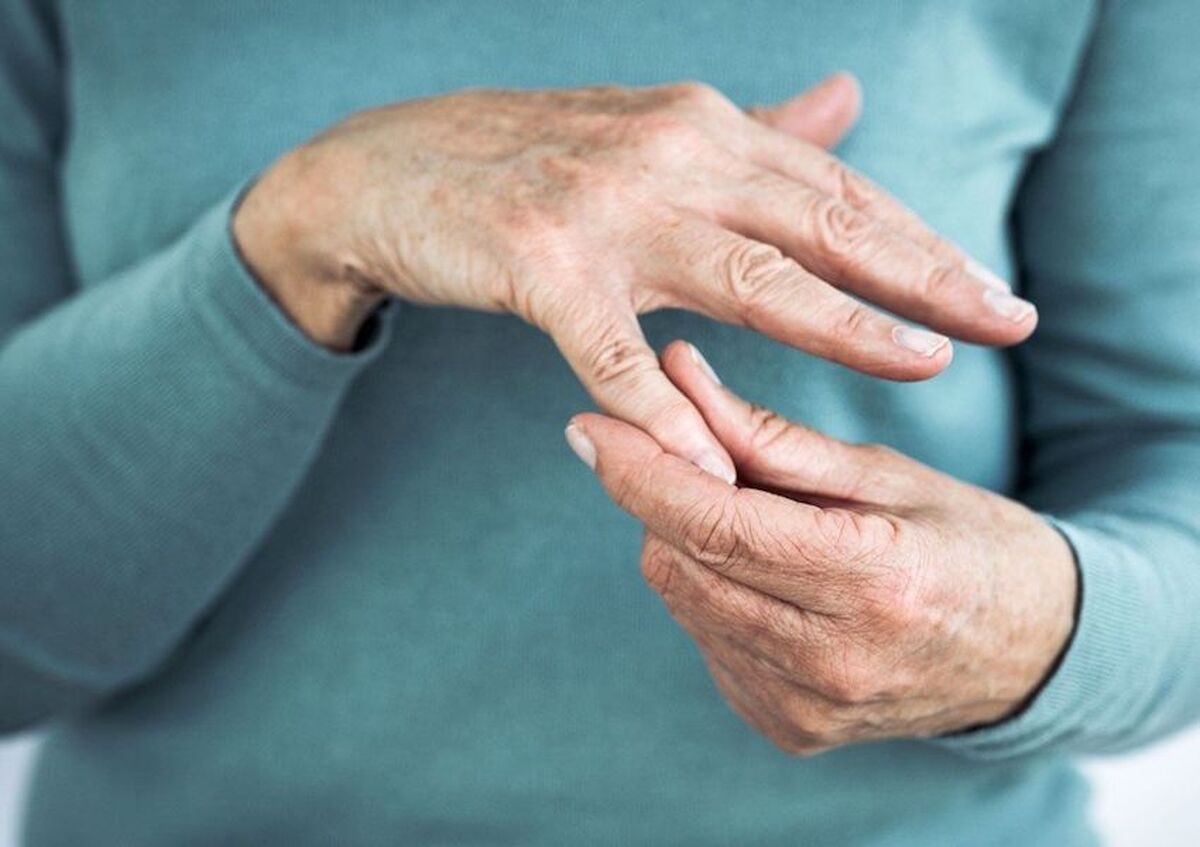 برای درمان آرتروز دست چه کنیم؟
