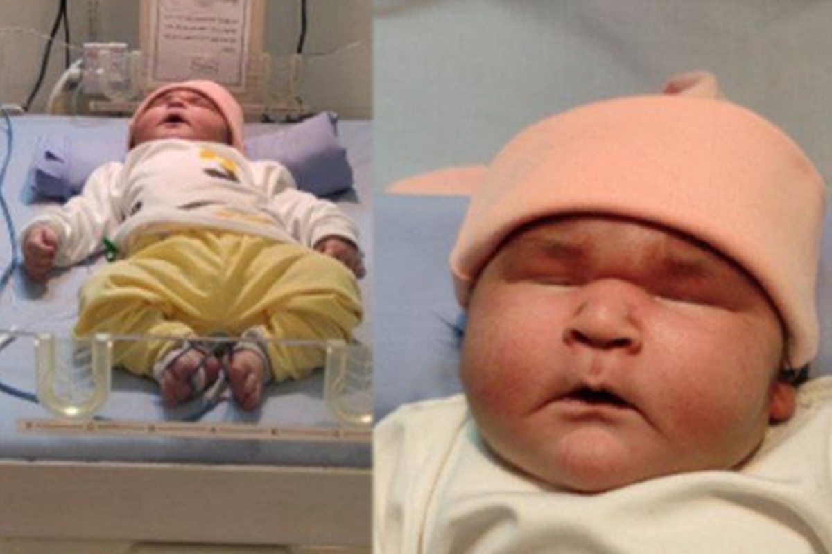 ویدئو | سنگین ترین نوزاد ایرانی در مشهد به دنیا آمد