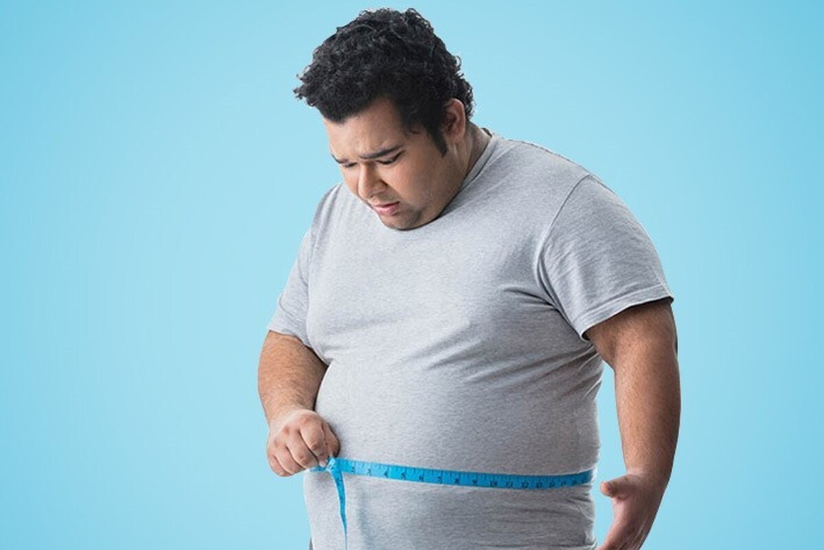 جراحی چاقی، در افرادی که BMI یا شاخص توده بدنی بالای ۳۵ دارند، ضروری است