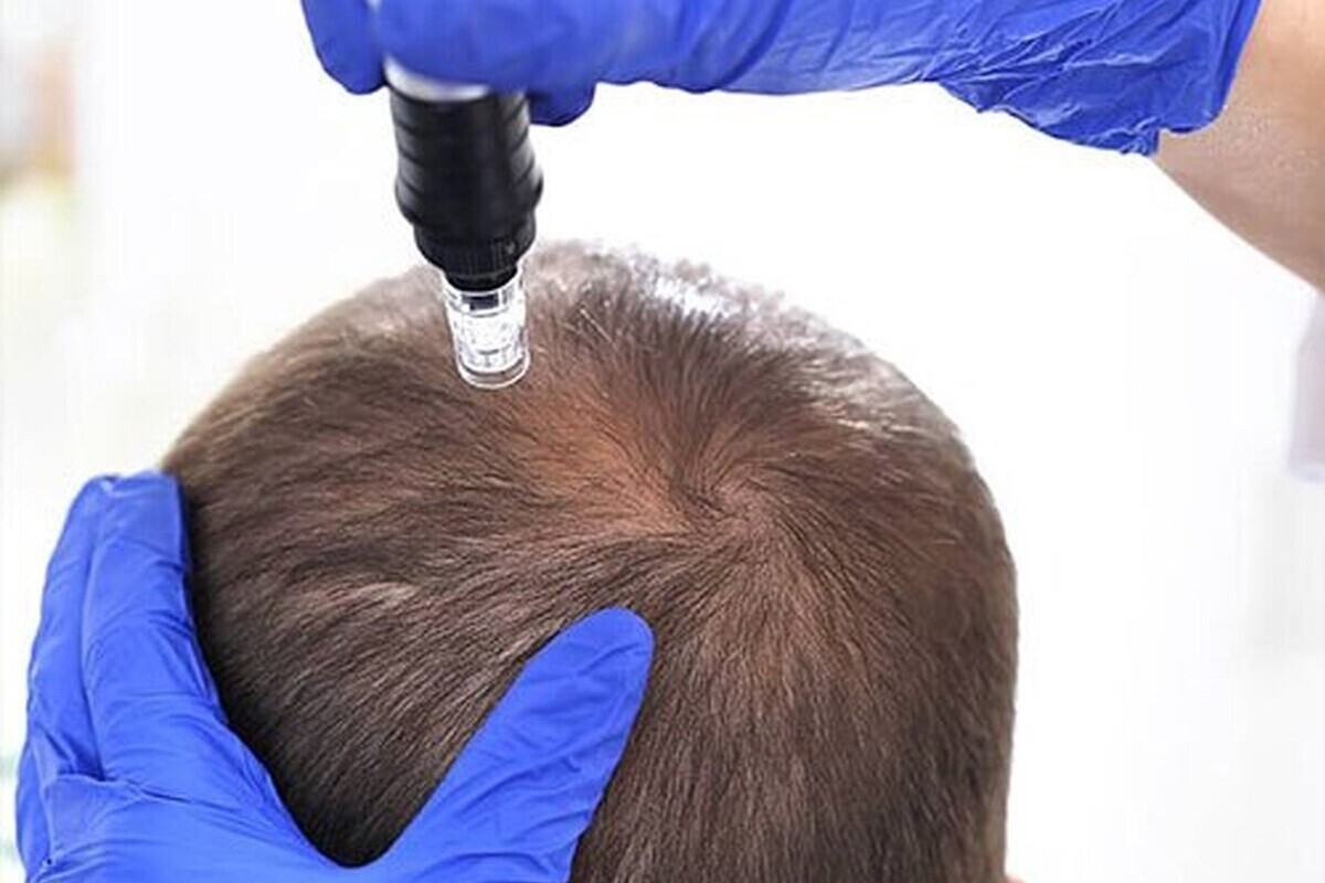 اینفوگرافی| هشت ماده تقویت کننده مو را بشناسید