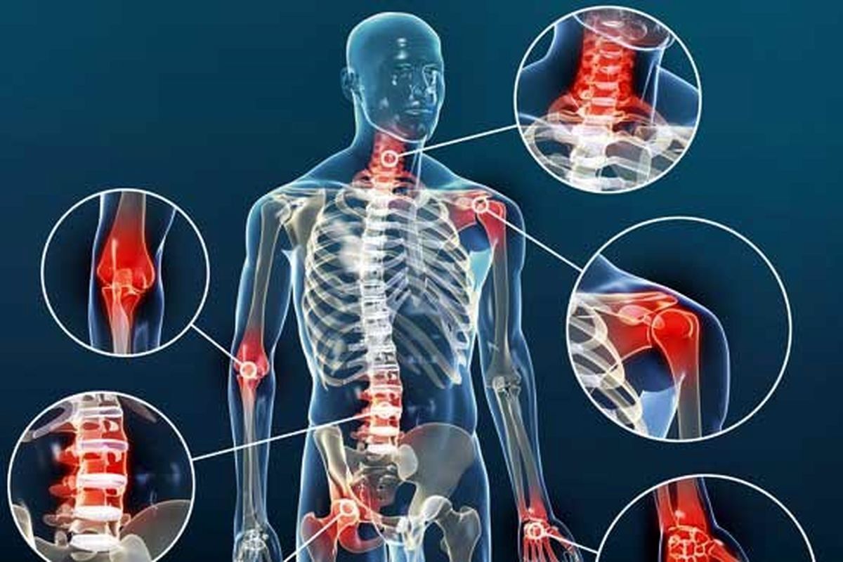 مدیرکل دفتر بهبود تغذیه جامعه وزارت بهداشت اظهار کرد: با افزایش سن به‌ویژه در دوران یائسگی، اگر درد‌های استخوانی آغاز شود، این می‌تواند نشانه‌ای از خطر ابتلا به پوکی استخوان باشد. برای پیشگیری و مدیریت این وضعیت، مصرف منظم لبنیات، میوه‌ها و سبزیجات را در برنامه غذایی خود قرار دهید و مصرف نمک را کاهش دهید.