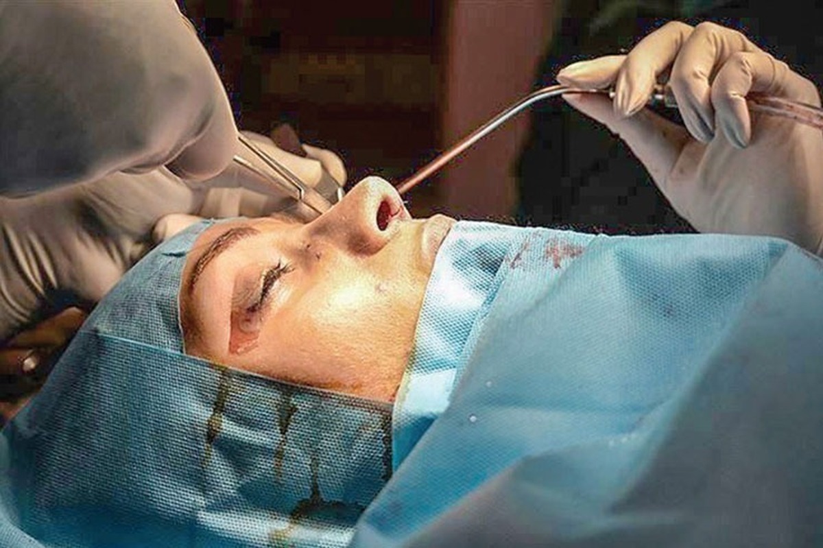 هشدار انجمن جراحان آمریکا درباره عوارض عمل‌های زیبایی زنان