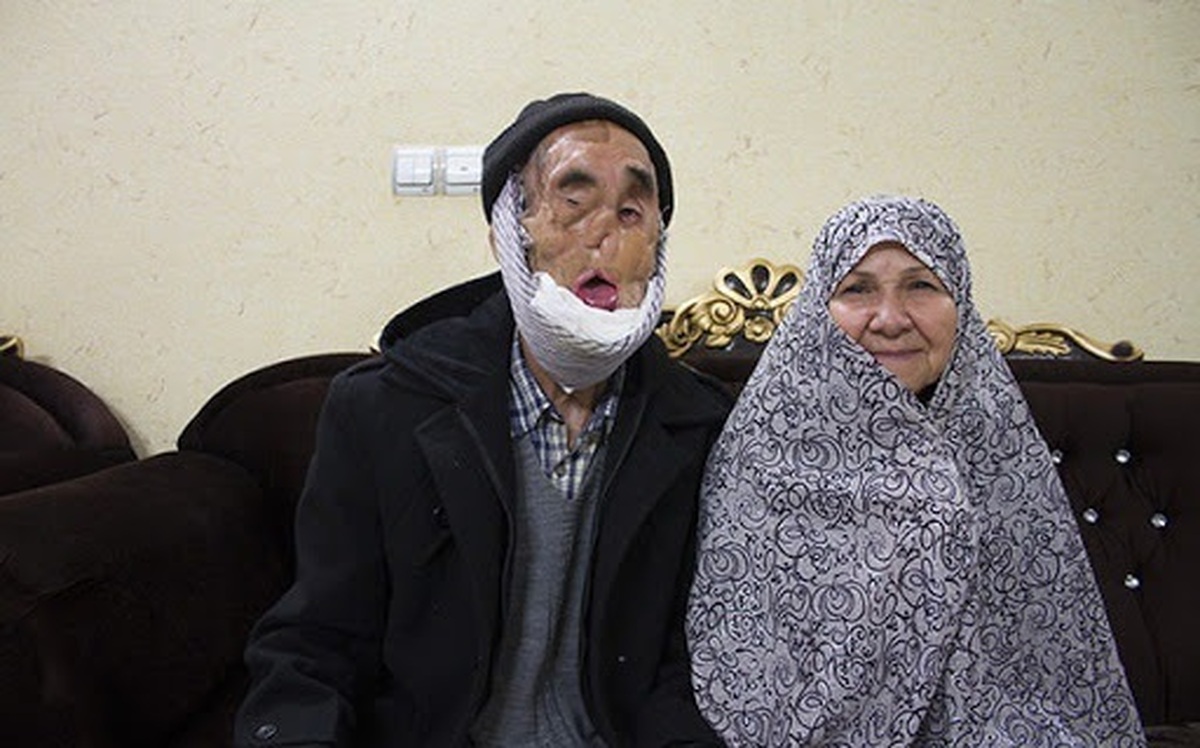 بازنشر به‌مناسبت سالروز شهادت بابا رجب محمدزاده؛ زیباترین چهره با زخم‌های تلخ جنگ