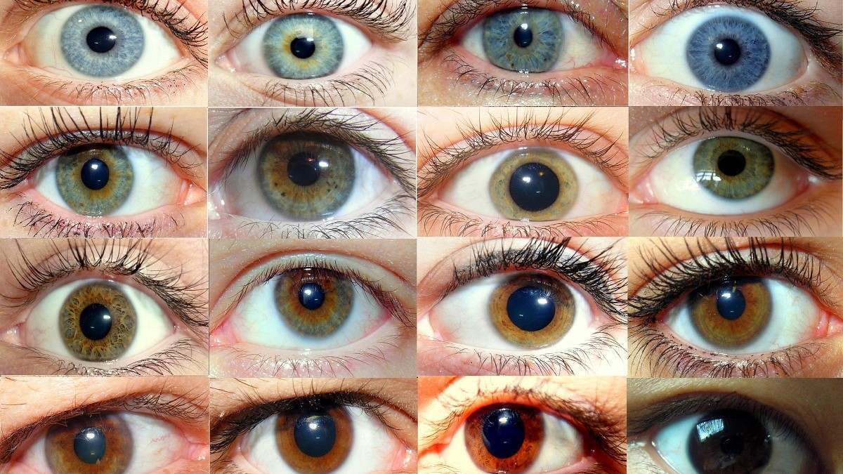 متقاضیان جراحی تغییر رنگ چشم بخوانند | چه کسانی مجاز هستند؟