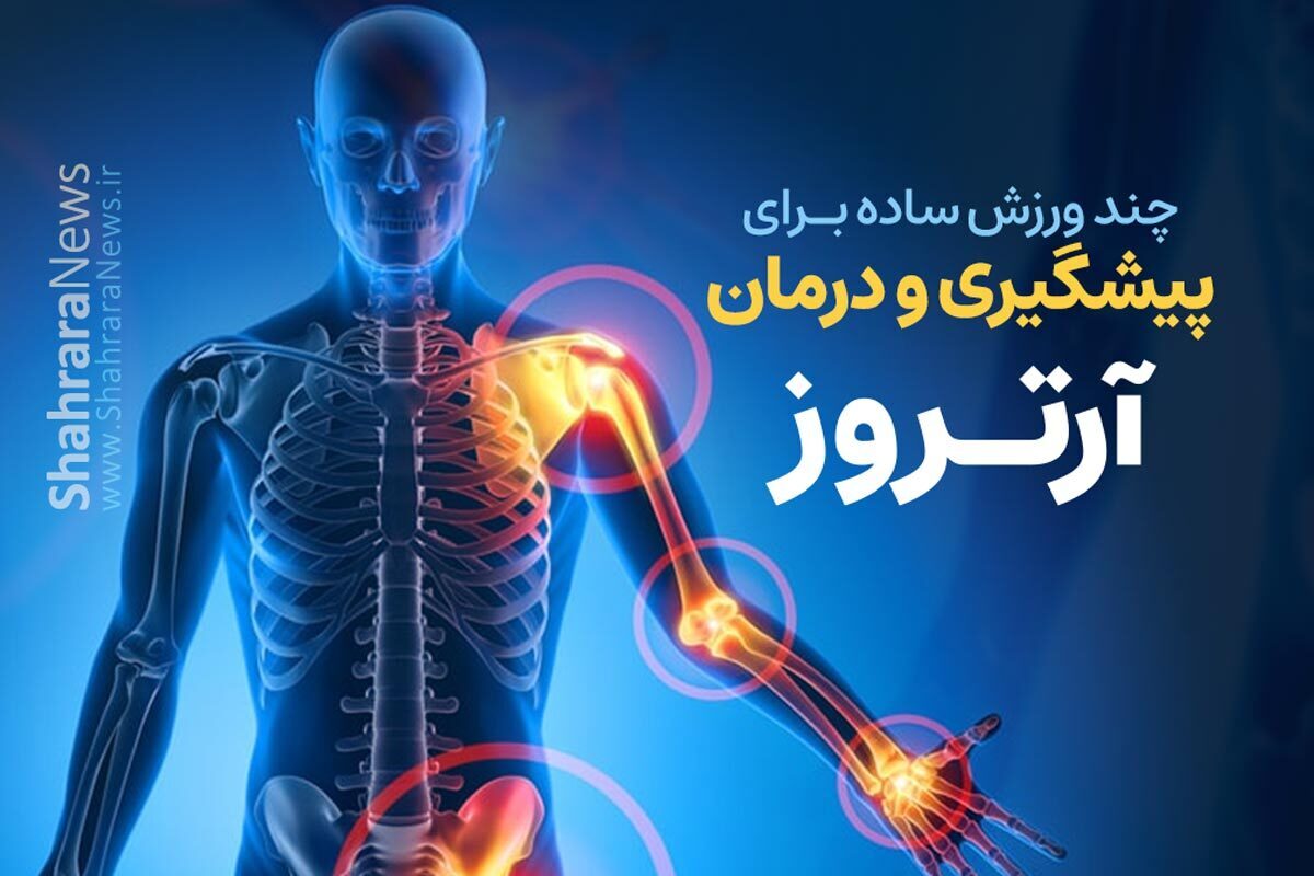 اینفوگرافی | چند روش ساده برای پیشگیری و درمان آرتروز